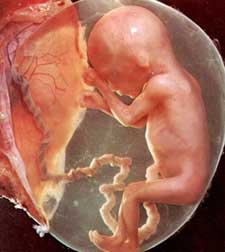 embryo