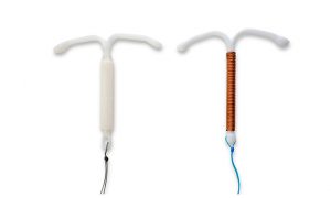 intrauterine device (IUD)