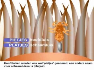 pubic lice (crabs)