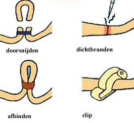 What is the operation like?