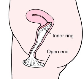how to use the female condom
