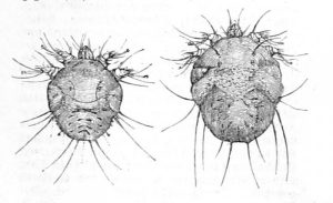 scabies (the itch)